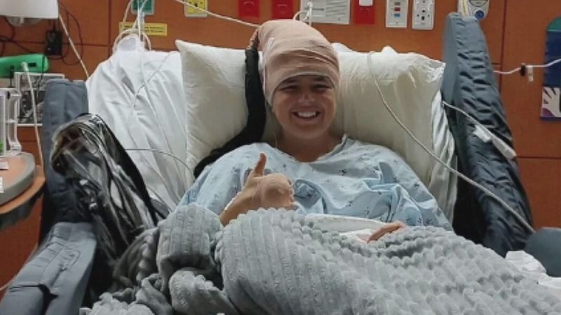 大脑植入物拯救女性免受癫痫发作